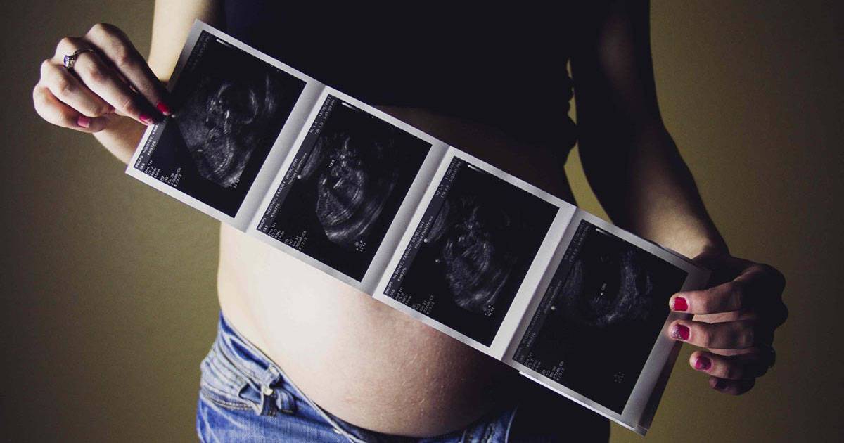 guide-congenital-anomaly-scan-og-image